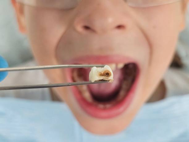 Best Cosmetic Emergency Dentistry in Marion, NC